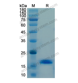 重组IFNG/IFN-gamma蛋白,Recombinant Human IFNG/IFN-gamma, N-His