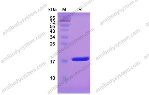 重组IL1B/IL1F2蛋白,Recombinant Human IL1B/IL1F2, C-His
