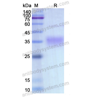 重组EPO蛋白,Recombinant Human EPO, C-His