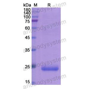 Recombinant Human TIMP1, N-His