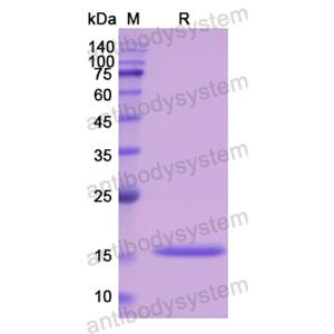 Recombinant Human CST3, C-His