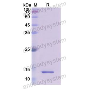 Recombinant Human HRAS, N-His