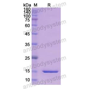 Recombinant Human PENK, N-His