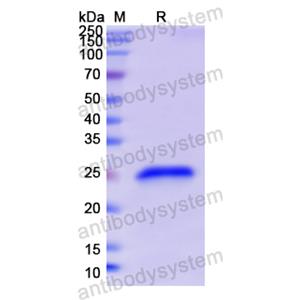 Recombinant Human GH1, N-His