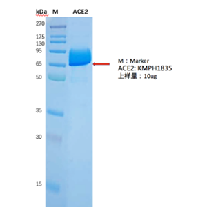 重组人ACE2蛋白,Recombinant Human ACE2 Protein, His Tag