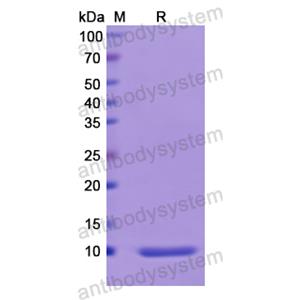 Recombinant Human PTH, N-His