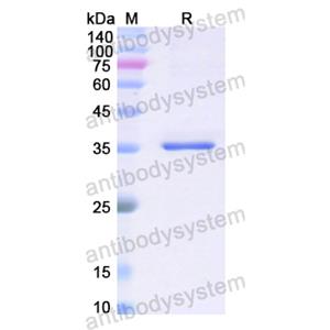 Recombinant Human PTH, N-GST