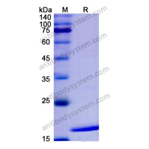 重组IFNA1/Interferon alpha-D蛋白,Recombinant Human IFNA1/Interferon alpha-D, N-His