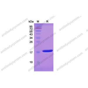 重组IL1B/IL1F2蛋白,Recombinant Human IL1B/IL1F2, C-His