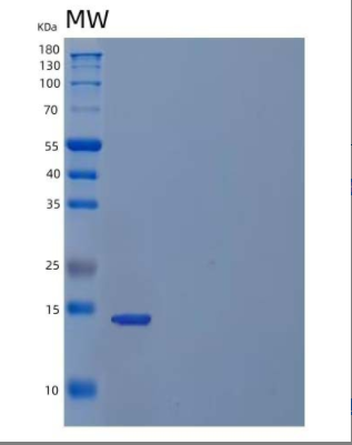 Recombinant Human Inhibin β C Chain/INHBC Protein(N-6His),Recombinant Human Inhibin β C Chain/INHBC Protein(N-6His)