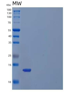 Recombinant Human C-X-C Motif Chemokine 9/CXCL9/MIG Protein(C-6His),Recombinant Human C-X-C Motif Chemokine 9/CXCL9/MIG Protein(C-6His)