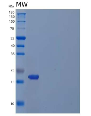 Recombinant Human Inosine Triphosphate Pyrophosphatase/ITPase Protein(C-6His),Recombinant Human Inosine Triphosphate Pyrophosphatase/ITPase Protein(C-6His)