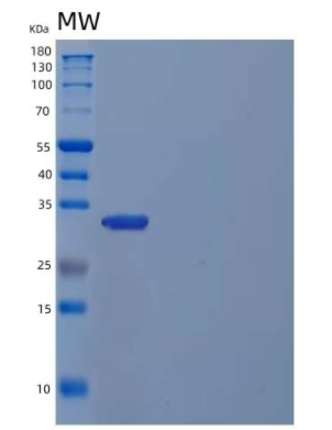 Recombinant Human Inositol Monophosphatase 1/IMPA1/IIMPase 2 Protein(N-6His),Recombinant Human Inositol Monophosphatase 1/IMPA1/IIMPase 2 Protein(N-6His)