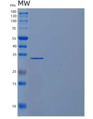 Recombinant Human Inositol Monophosphatase 2/IMPase 2 Protein(N-6His),Recombinant Human Inositol Monophosphatase 2/IMPase 2 Protein(N-6His)