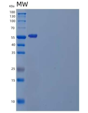 Recombinant Human Peptidase D/PEPD Protein,Recombinant Human Peptidase D/PEPD Protein