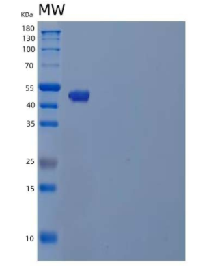 Recombinant Human Tubulin β-4A Chain/TUBB4A Protein(N-6His),Recombinant Human Tubulin β-4A Chain/TUBB4A Protein(N-6His)