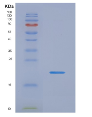 Recombinant Interleukin 13 (IL13),Recombinant Interleukin 13 (IL13)