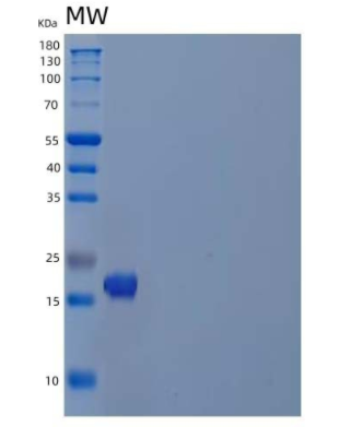 Recombinant Human Peptidyl-Prolyl Cis-Trans Isomerase-Like 1 Protein,Recombinant Human Peptidyl-Prolyl Cis-Trans Isomerase-Like 1 Protein