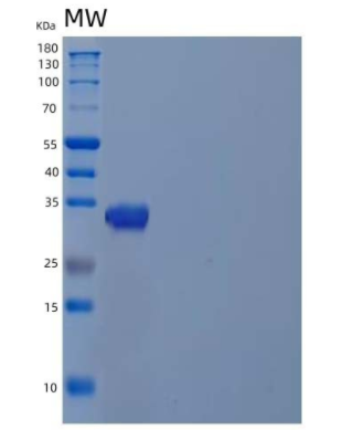 Recombinant Human Cyclophilin C/PPIase C/PPIC Protein(N-Trx, 6His),Recombinant Human Cyclophilin C/PPIase C/PPIC Protein(N-Trx, 6His)