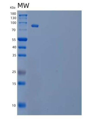 Recombinant Human Phosphatidylinositol 4-Kinase β/PI4KB Protein(C-6His),Recombinant Human Phosphatidylinositol 4-Kinase β/PI4KB Protein(C-6His)