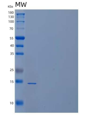 Recombinant Human Cystatin C/CST3 Protein,Recombinant Human Cystatin C/CST3 Protein