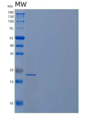 Recombinant Human Tumor Necrosis Factor α/TNFα Protein(N-6His),Recombinant Human Tumor Necrosis Factor α/TNFα Protein(N-6His)