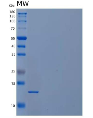 Recombinant Human Cystatin C/CST3 Protein,Recombinant Human Cystatin C/CST3 Protein