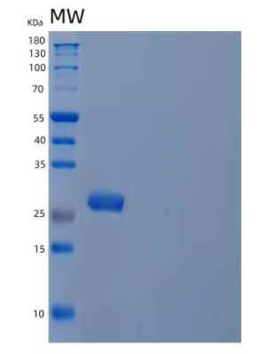 Recombinant Human Peroxiredoxin-6/PRDX6 Protein(N-6His),Recombinant Human Peroxiredoxin-6/PRDX6 Protein(N-6His)