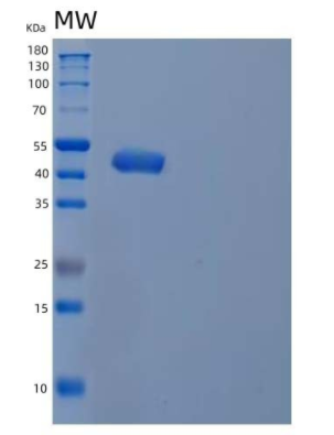 Recombinant Human Type I Inositol 1,4,5-Trisphosphate 5-Phosphatase/INPP5A Protein(C-6His),Recombinant Human Type I Inositol 1,4,5-Trisphosphate 5-Phosphatase/INPP5A Protein(C-6His)