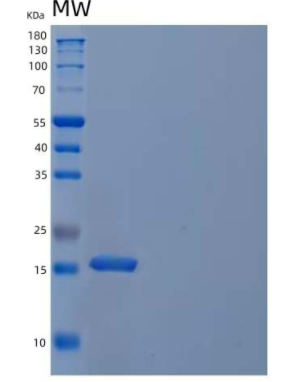 Recombinant Human Cystatin S/CST4 Protein(C-6His),Recombinant Human Cystatin S/CST4 Protein(C-6His)