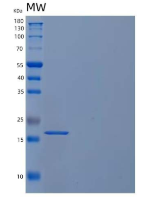 Recombinant Human U6 snRNA-Associated Sm-Like Protein LSm1/LSM1 Protein(C-6His),Recombinant Human U6 snRNA-Associated Sm-Like Protein LSm1/LSM1 Protein(C-6His)