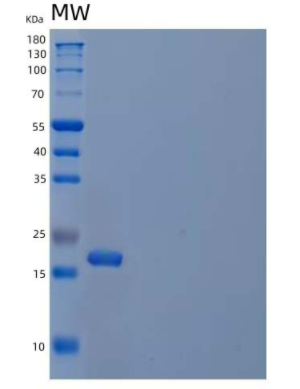 Recombinant Human Cystatin F/CST7 Protein(C-6His),Recombinant Human Cystatin F/CST7 Protein(C-6His)