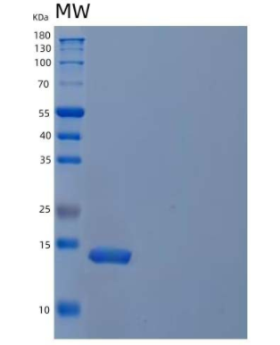 Recombinant Mouse Interleukin-21/IL-21 Protein(N-6His),Recombinant Mouse Interleukin-21/IL-21 Protein(N-6His)