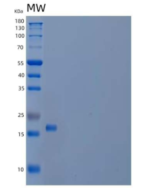 Recombinant Mouse Interleukin-22/IL-22 Protein,Recombinant Mouse Interleukin-22/IL-22 Protein