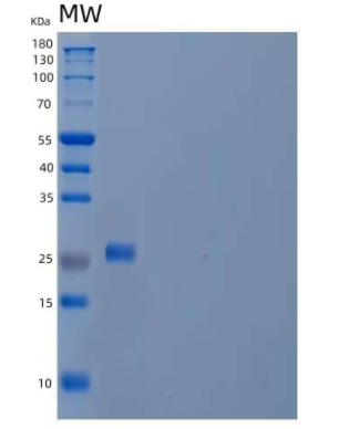 Recombinant Human Acrosomal Protein SP-10/ACRV1 Protein(C-6His),Recombinant Human Acrosomal Protein SP-10/ACRV1 Protein(C-6His)