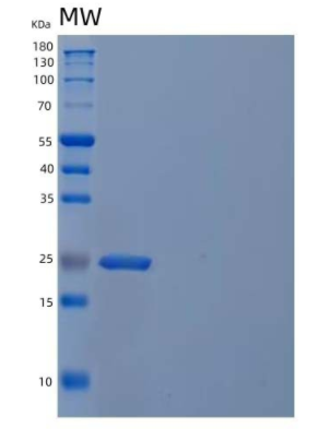 Recombinant Human 5-Formyltetrahydrofolate Cyclo-Ligase/MTHFS Protein(C-6His),Recombinant Human 5-Formyltetrahydrofolate Cyclo-Ligase/MTHFS Protein(C-6His)