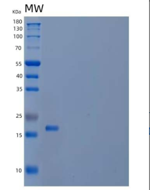 Recombinant Mouse Interleukin-3/IL-3 Protein(C-6His),Recombinant Mouse Interleukin-3/IL-3 Protein(C-6His)