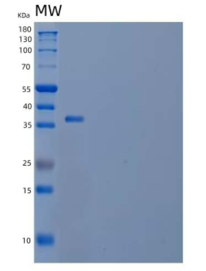 Recombinant Human Actin-Related Protein 8/ACTR8 Protein(N-6His),Recombinant Human Actin-Related Protein 8/ACTR8 Protein(N-6His)