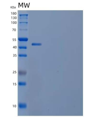 Recombinant Human Ubiquitin Thioesterase OTUB2/OTUB2 Protein(N-GST),Recombinant Human Ubiquitin Thioesterase OTUB2/OTUB2 Protein(N-GST)