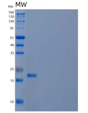 Recombinant Human Cytochrome b5/CYB5A Protein(N-6His),Recombinant Human Cytochrome b5/CYB5A Protein(N-6His)