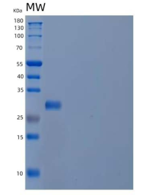 Recombinant Human Phosphomannomutase 2/PMM2 Protein(C-6His),Recombinant Human Phosphomannomutase 2/PMM2 Protein(C-6His)