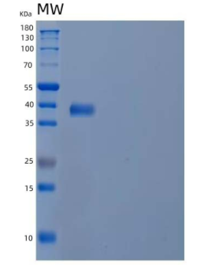 Recombinant Human Cytochrome b-c1 Complex Subunit 6/UQCRH Protein(N-GST),Recombinant Human Cytochrome b-c1 Complex Subunit 6/UQCRH Protein(N-GST)