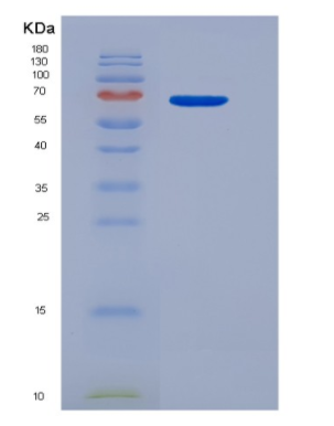 Eukaryotic Interleukin 13 (IL13),Eukaryotic Interleukin 13 (IL13)