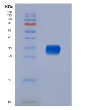 Eukaryotic Interleukin 6 (IL6),Eukaryotic Interleukin 6 (IL6)