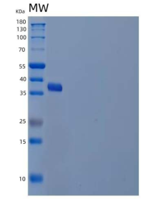 Recombinant Human Ubiquitin-Conjugating Enzyme E2 J2/UBE2J2 Protein(N-GST),Recombinant Human Ubiquitin-Conjugating Enzyme E2 J2/UBE2J2 Protein(N-GST)