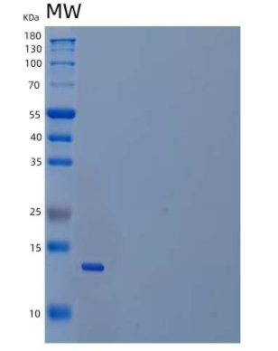 Recombinant Human Cytoplasmic Dynein Light Chain 1/DYNLL1 Protein(N-6His),Recombinant Human Cytoplasmic Dynein Light Chain 1/DYNLL1 Protein(N-6His)