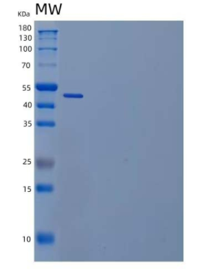 Recombinant Human Ubiquitin-Conjugating Enzyme E2 S/UBE2S Protein(N-GST),Recombinant Human Ubiquitin-Conjugating Enzyme E2 S/UBE2S Protein(N-GST)