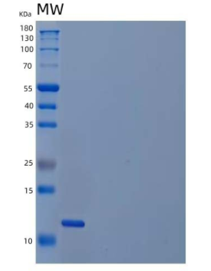 Recombinant Human Platelet-Derived Growth Factor BB/PDGF-BB Protein,Recombinant Human Platelet-Derived Growth Factor BB/PDGF-BB Protein