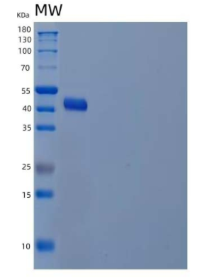 Recombinant Human Alcohol Dehydrogenase Class 4 Mu/ADH7 Protein(C-6His),Recombinant Human Alcohol Dehydrogenase Class 4 Mu/ADH7 Protein(C-6His)