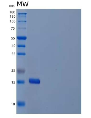 Recombinant Human Interleukin-21/IL-21 Protein,Recombinant Human Interleukin-21/IL-21 Protein